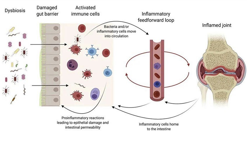Anti Inflammatory Probiotics